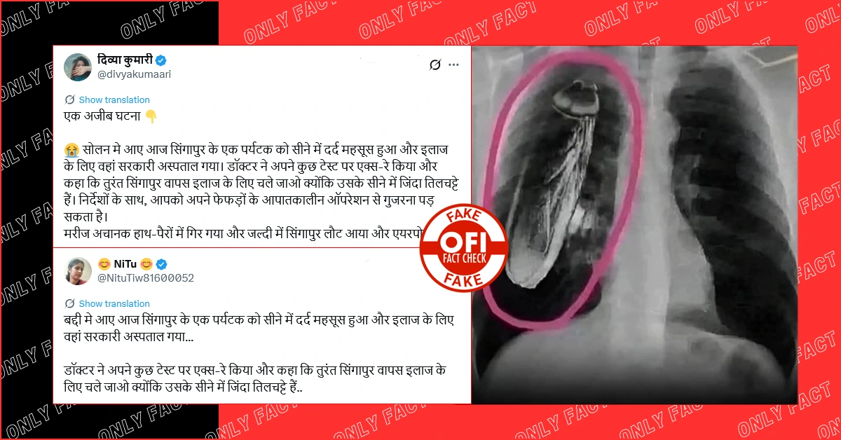 एक्स-रे मशीन में कॉकरोच होने का दावा फर्जी, वायरल तस्वीर एडिटेड है  